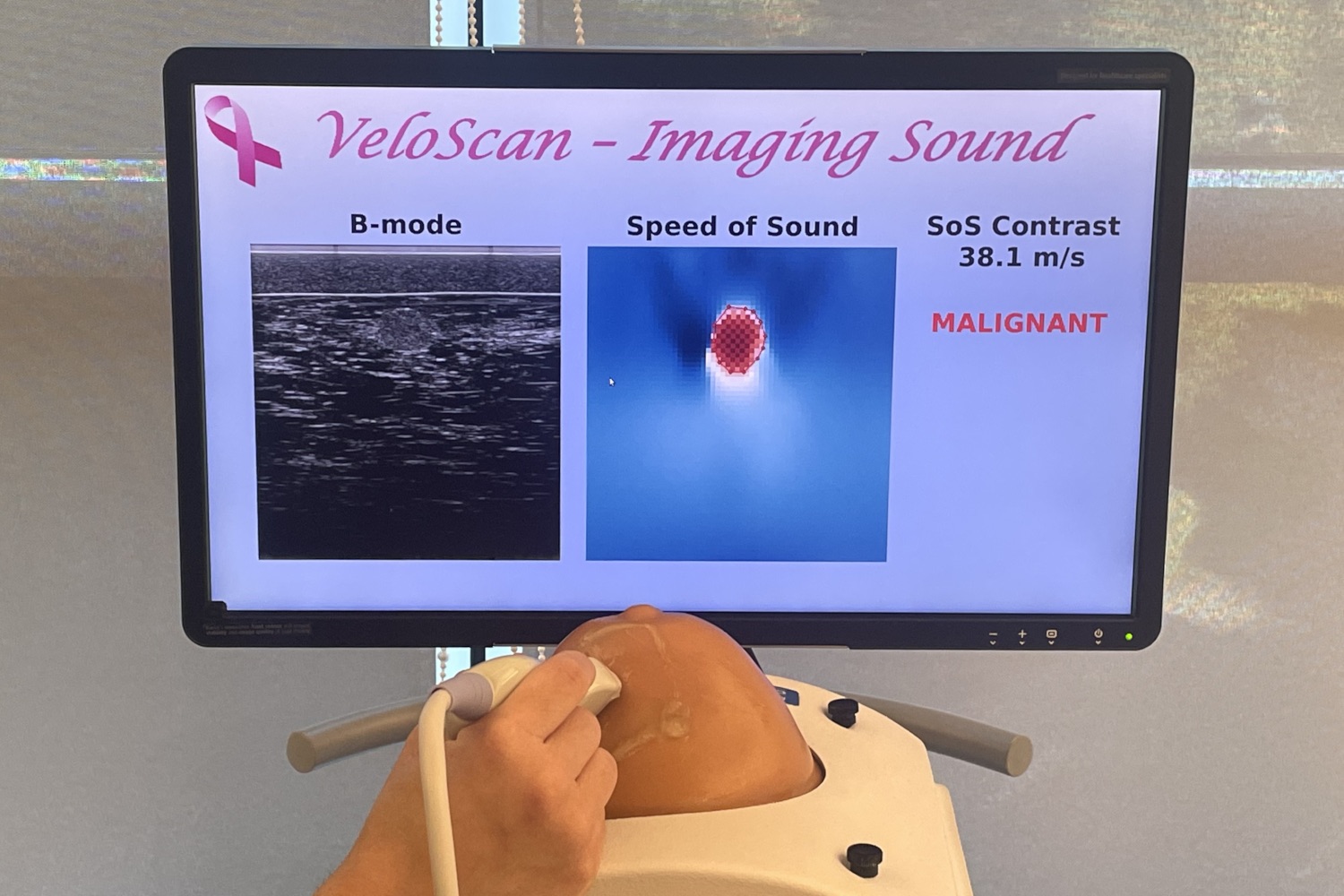 Sound-speed ultrasound imaging research visual