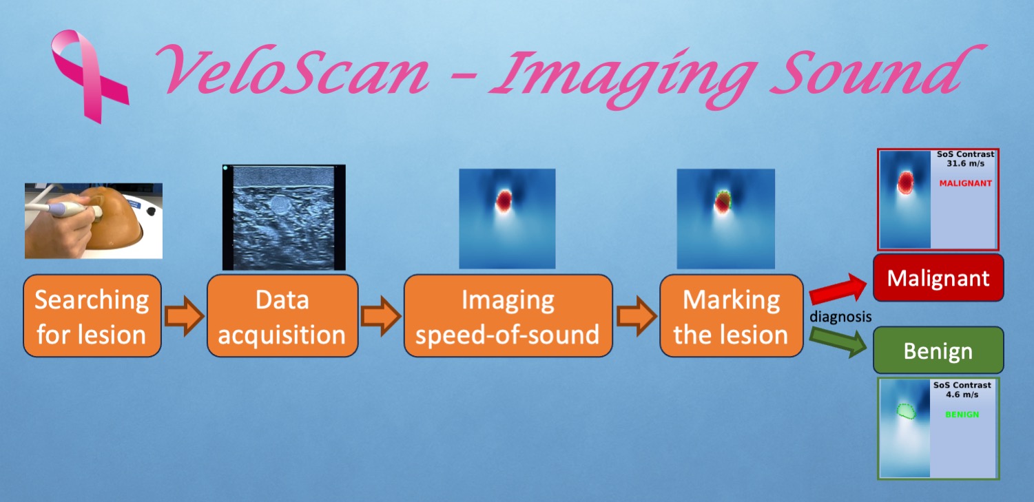 Sound-speed ultrasound processing pipeline