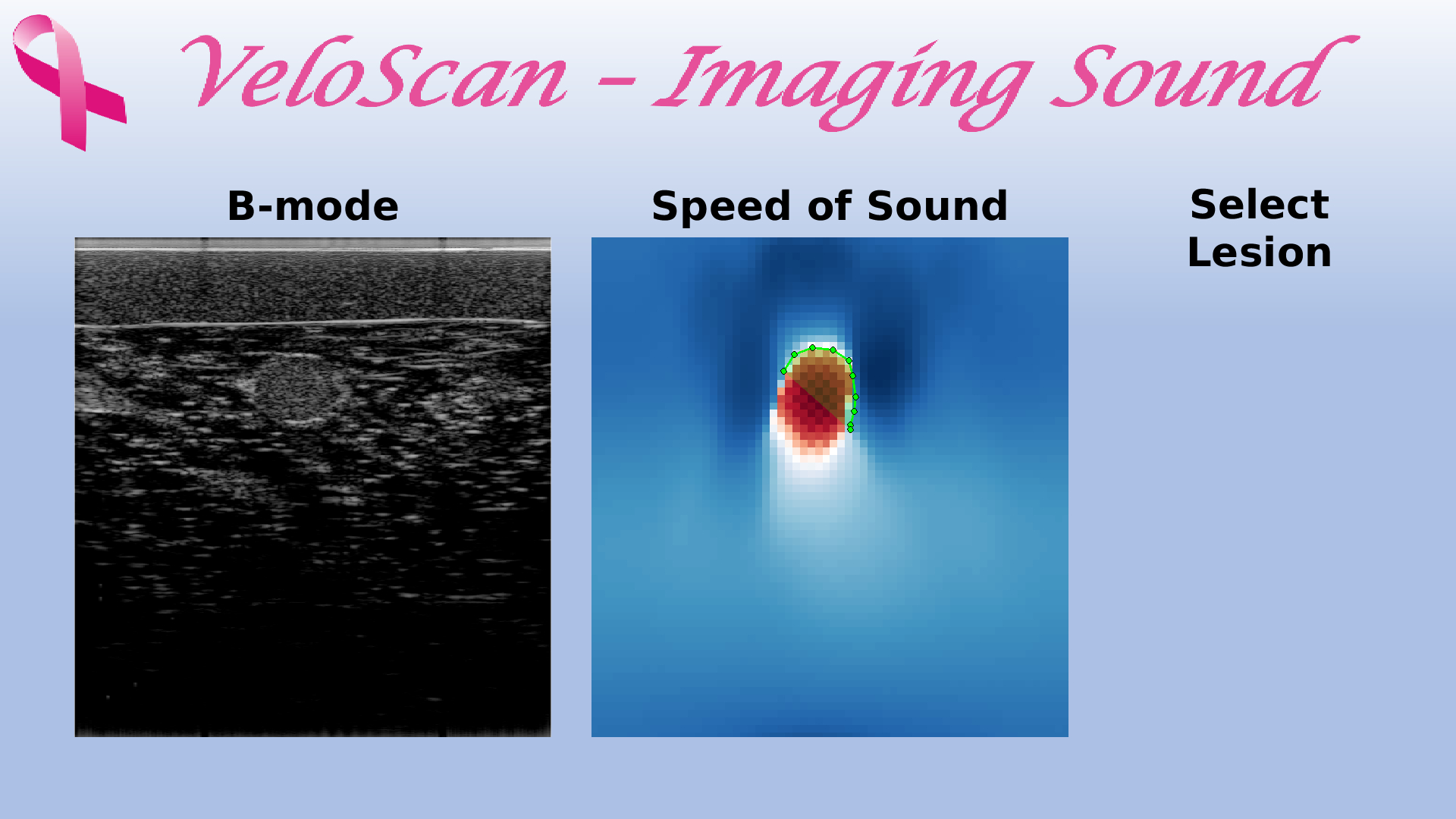 Clinical annotation and evaluation of ultrasound data
