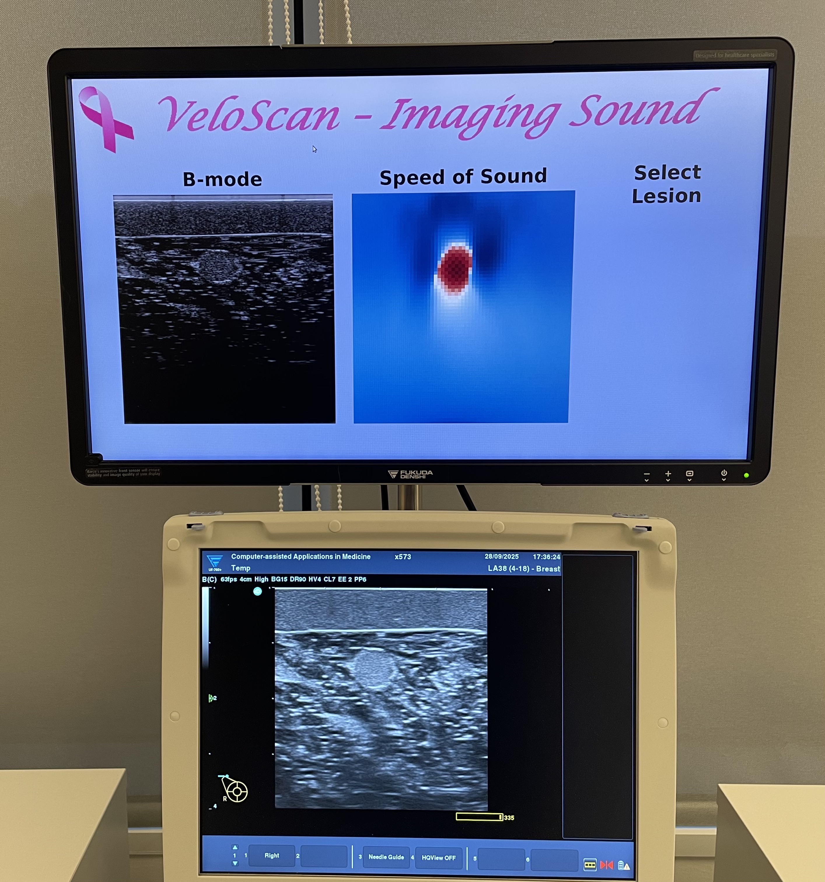 Clinical ultrasound system for sound-speed imaging development