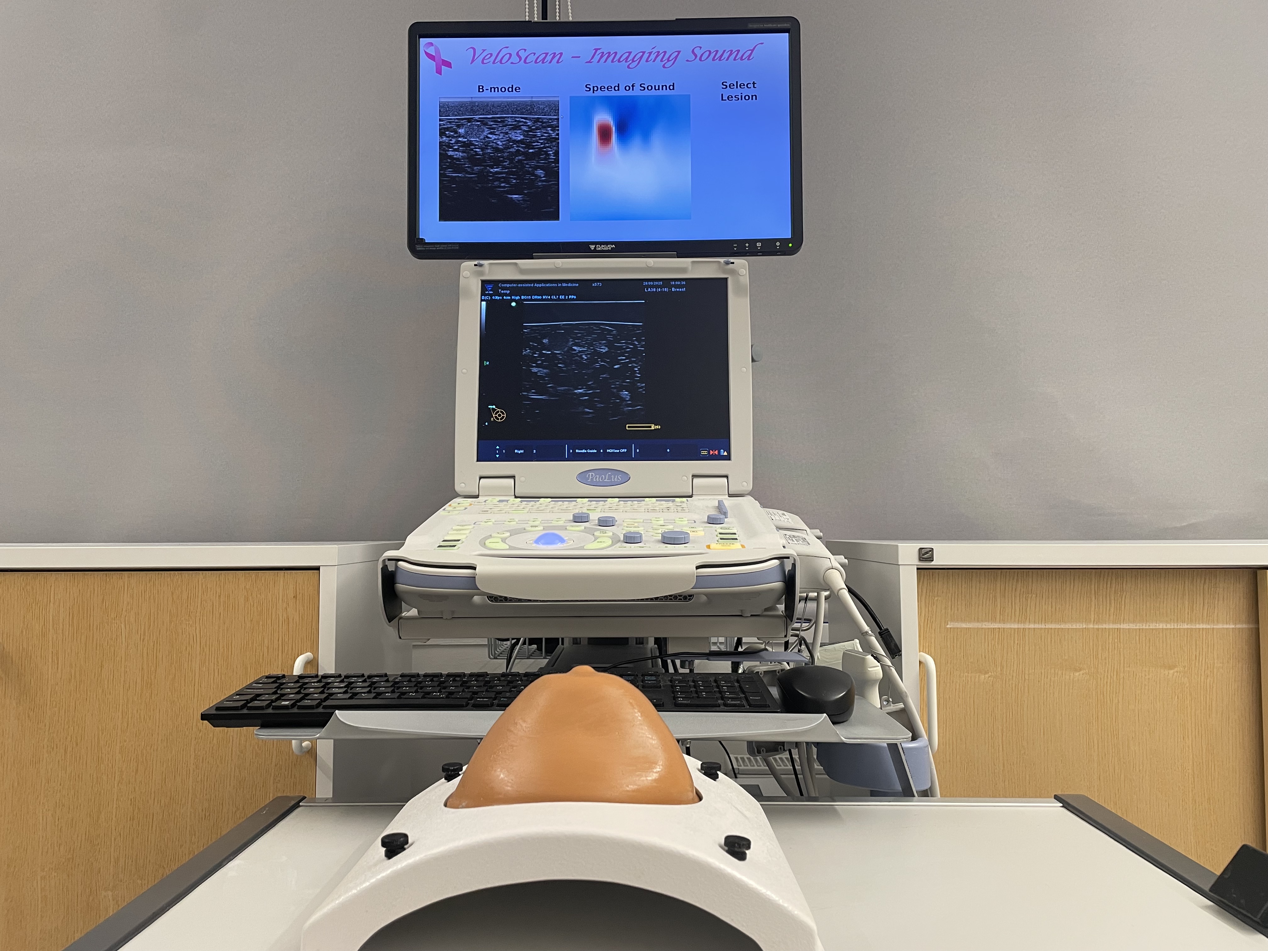 Ultrasound system used in a breast imaging context