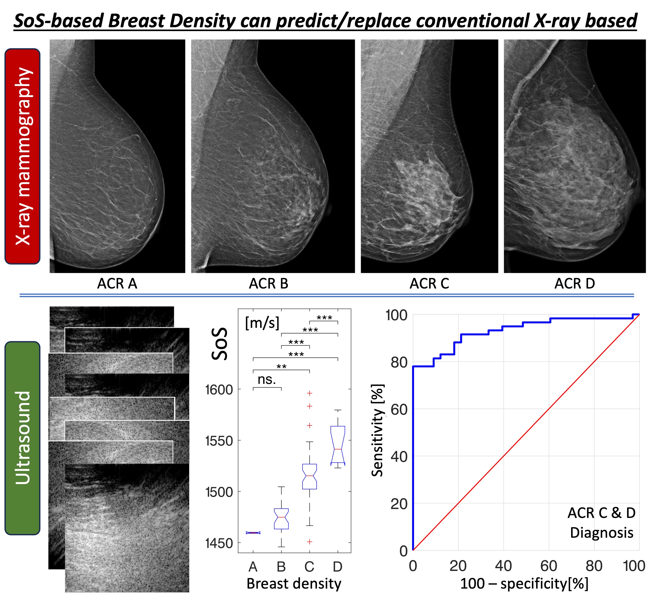 Sound-speed imaging example for breast density assessment